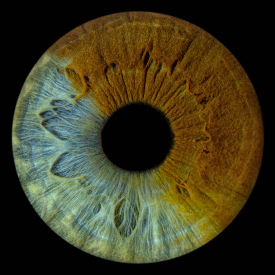 An iris split between olive-blue on one side and copper on the other