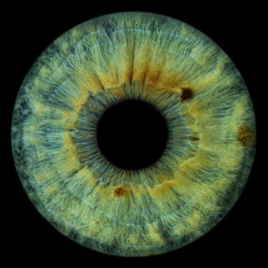 A grey-green iris with a gold ring around the pupil